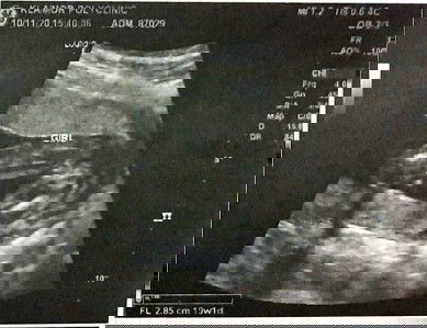 สอบถามผู้รู้ค่ะ