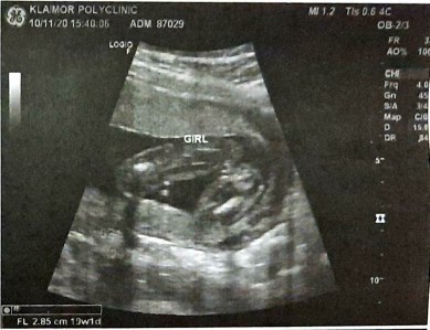 สอบถามผู้รู้ค่ะ