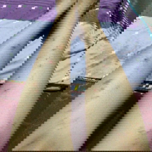 Gatal di trimester 2 & 3