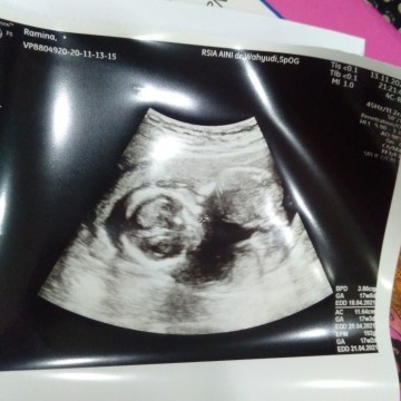 Mana yg sama Bun 17 week 2d