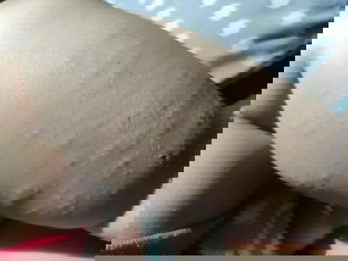 Betis bentol2 bruntusan