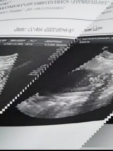 หนูผช.หรือผญ.ช่วยดูหน่อยค่ะ