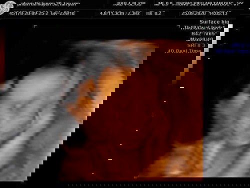 Trâu vàng đây ạ