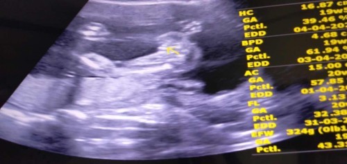 ผู้หญิงหรือผู้ชายคะ