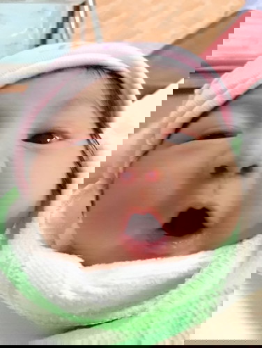 คลอดแล้ว ผ่าคลอด