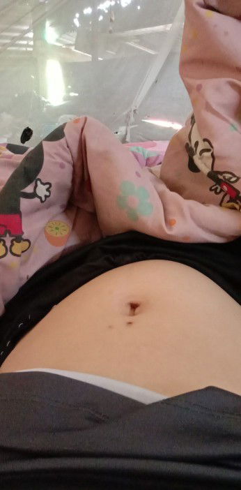 แม่ๆบ้านไหนเหมือนบ้านนี้บ้างค่ะ18วีคแล้วน้องชอบโผล่ออกมาบ่อยมากเลยค่ะโผล่ออกมาเฉยๆนะคะไม่ได้ดิ้น