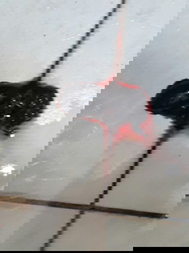 Blood clot and mucus plug