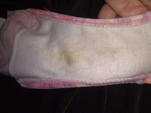 POSTPARTUM DISCHARGE