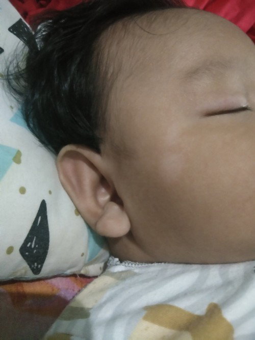 Bercak putih diwajah