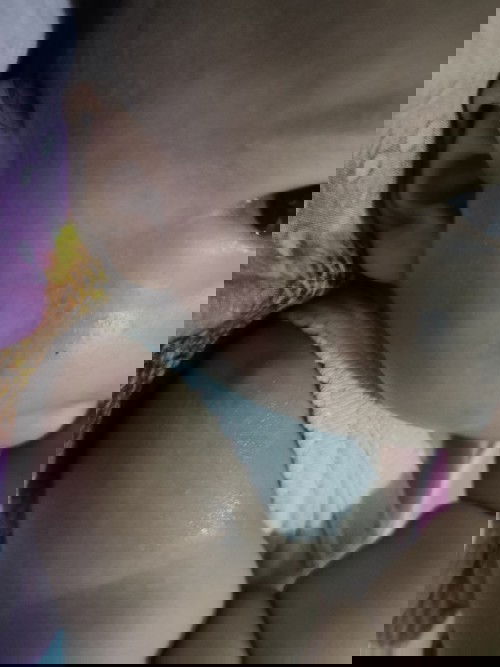 Bengkak setelah disuntik imunisasi