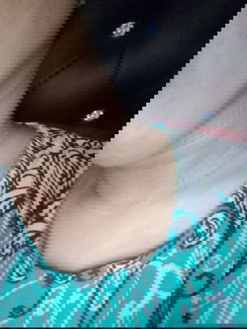 Gatal di bagian leher,dada,sangat pedih sampe iritasi..bagaimana pengobatannya?