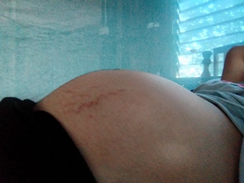 แม่ๆแนะนำครีมหน่อยค่ะ