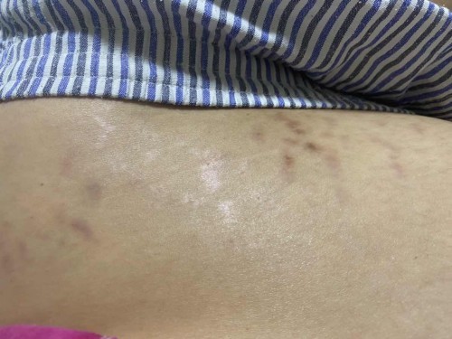 ว่าจะไม่แตกแล้วนะ 😂