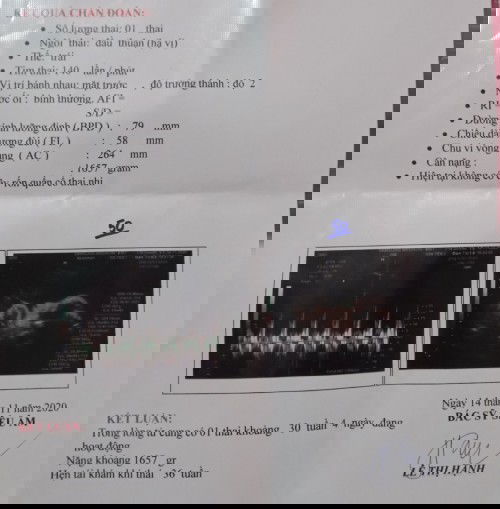 nay đi siêu âm được 30w4d con gái nặng 1657gr , mừng mún gớt nước mắt hehe ❤❤