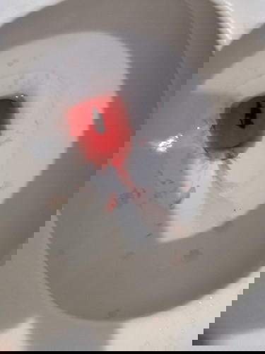 Early miscarriage today. π