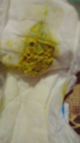 ขอคำแนะนำหน่อยค่ะ