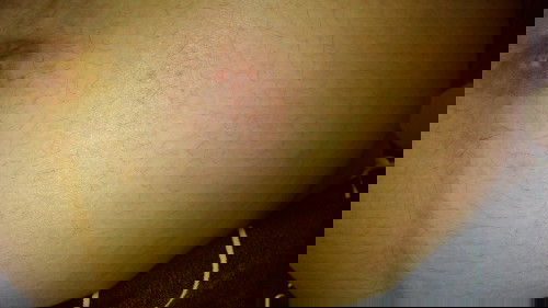 Hamil 9 bulan, perut sudah besar eh malah kegores spion mobil😭