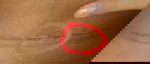 Yang pernah Sc, nanya dong bun ,,,