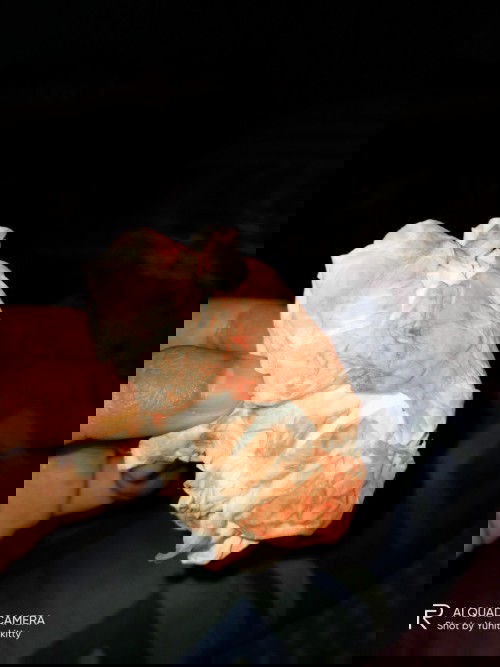 Kluar darah d uk 35 week