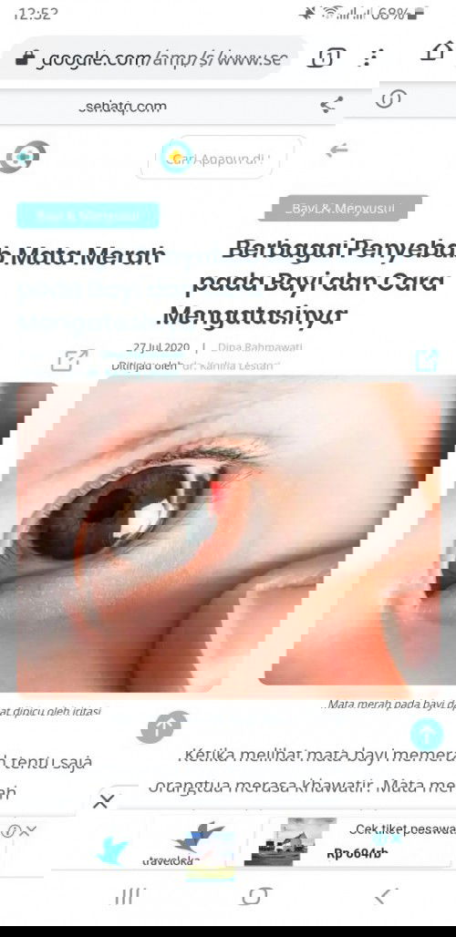 Mata merah pada bayi