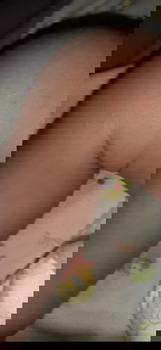 Banyak kutu air di area kaki bayi