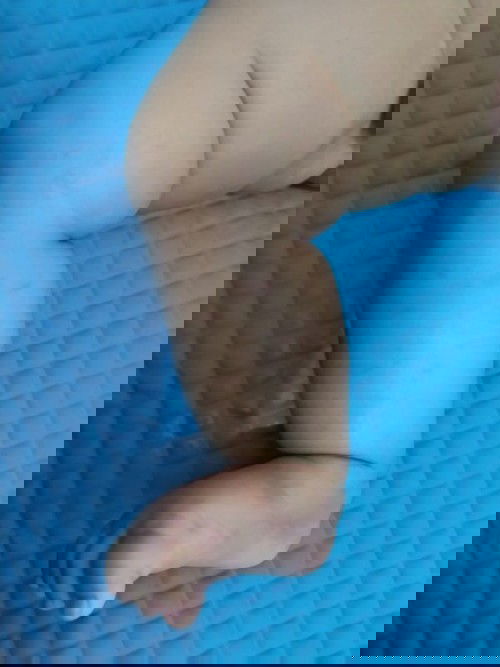 Bintik biru pada kaki