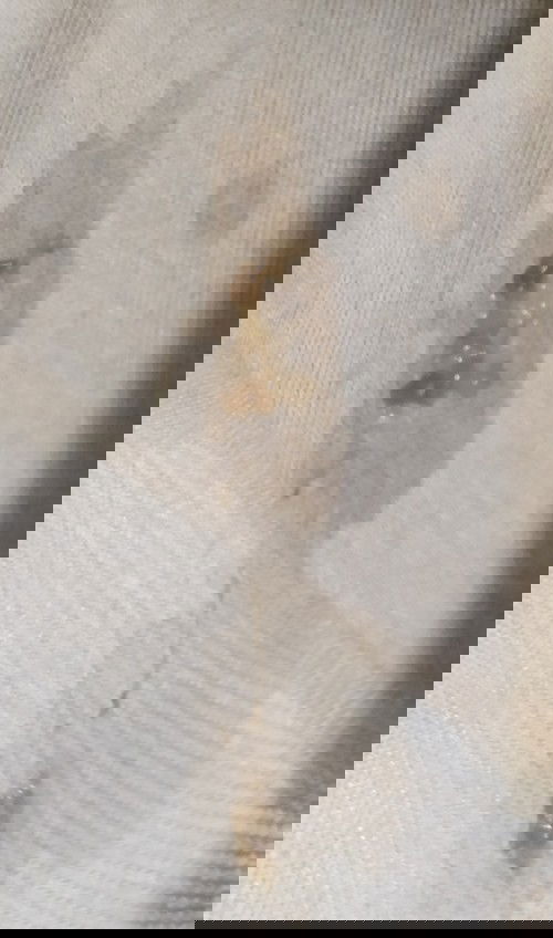 APAKAH INI YANG DI NAMAKAN FLEK ? USIA 30 WEEK