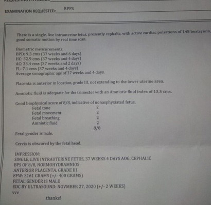 Result ng ultrasound ko