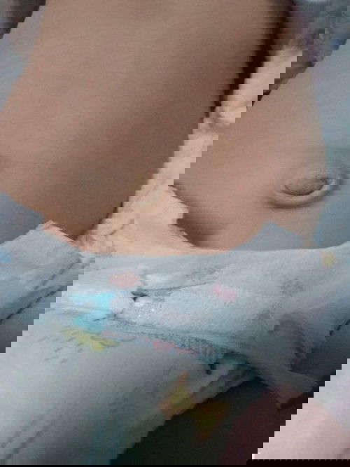 สะดือลูกปูดอันตรายมั้ยค่ะ