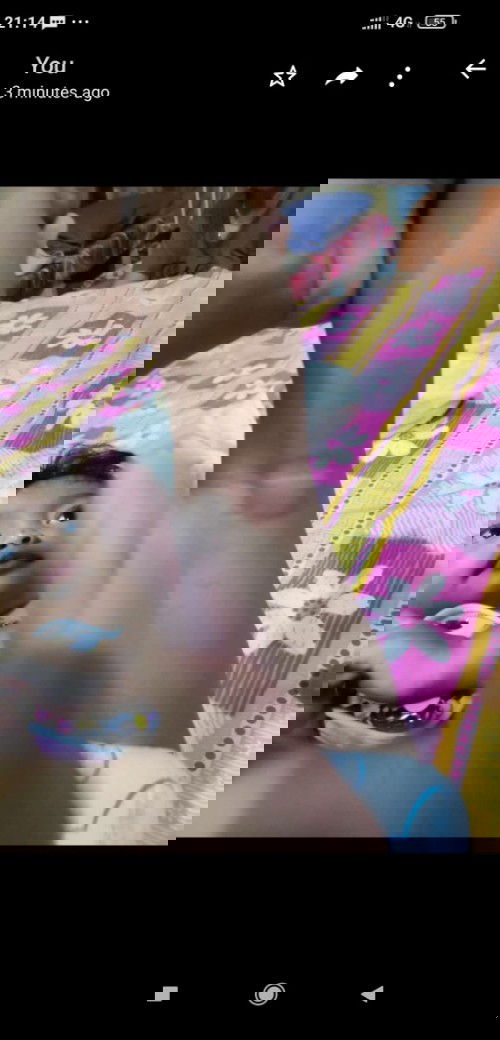 Kulit baby naik parut