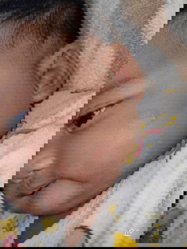 กากที่หน้า