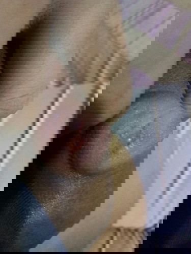 Parang blister sa nipple pano po gamutin? o anu po pwd gawin. Salamat po