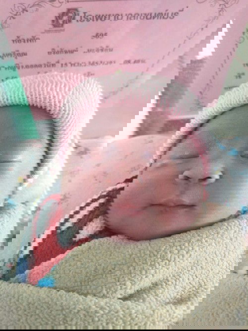 ประสบการณ์คลอดน้ำเดินตอนตี2 (36 สัปดาห์ 5 วัน)