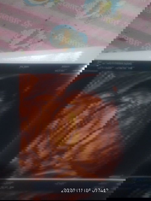 Bertanya berat badan janin