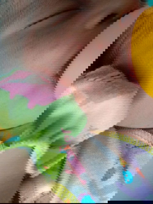 Bintik merah pada bayi