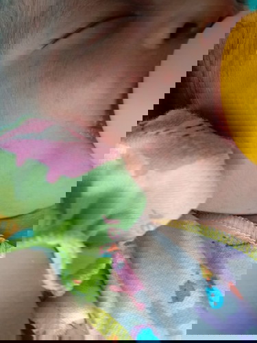 Bintik merah pada bayi