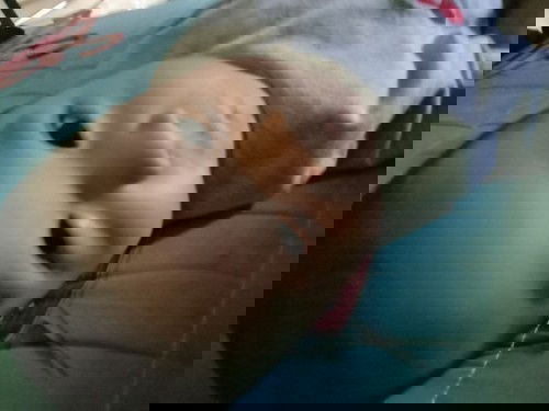 Mata belekan dan merah