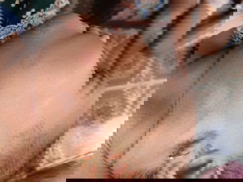 Akan mulai MPASI tp ada ruam diwajah