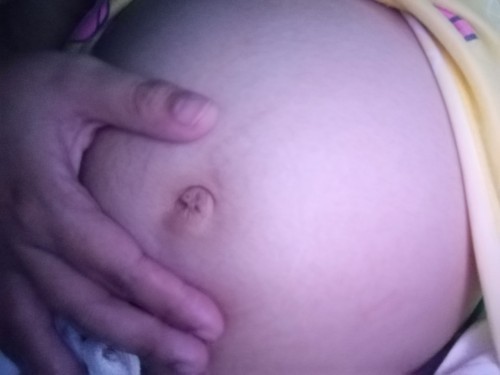 Normal Lang po ba ang pa nanakit Ng PUSOD mga MOM ung parang hinihila PO sa loob. 5months