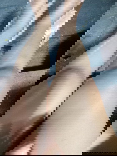 ขาบวมตึงและเจ็บเท้า