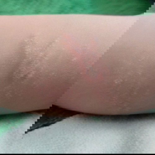 Tolong dong infonya🙏😢