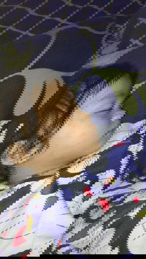 Imunisasi campak, panas  reda besuknya ada bercak merah