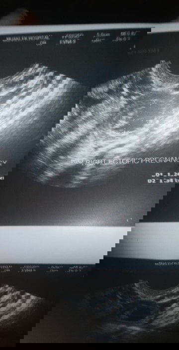 แบบนี้เสี่ยงท้องน้องมดลูกไหมค่ะ