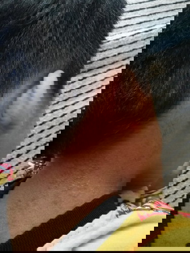 ลูกเป็นผื่น 3-4วันแล้วไม่หาย