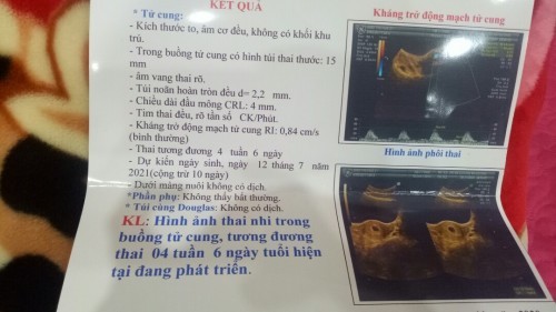 4w6d S âm:tim thai đều,rõ tần số chưa đo được số lần.5w5d S âm nơi khác thì chưa có❤️thai là sao ạ?