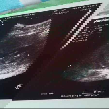 Usia kandungan udah 13 Minggu ,tapi perut masih blum keliatan gede ,apa itu normal bun,hamil pertama