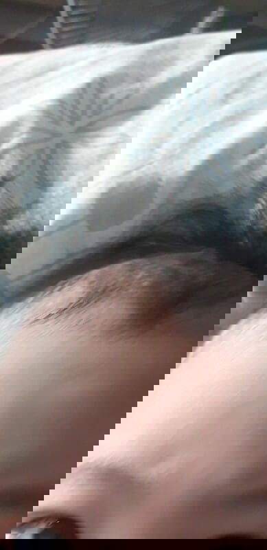 ทำยังไงให้หาย