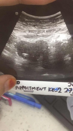 Scan my baby first