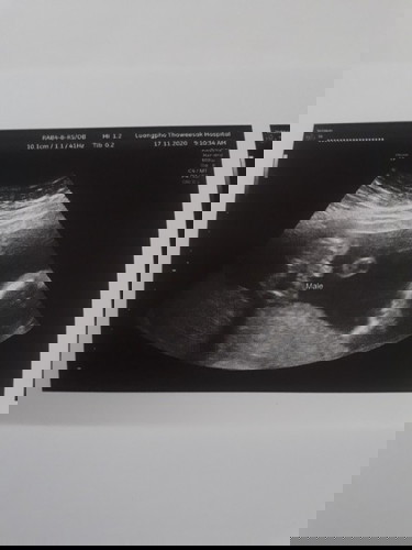 ใบซาวด์เพศลูก