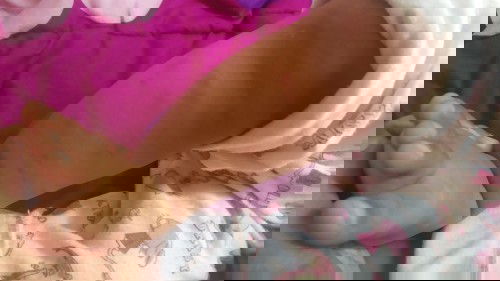 Bekas gigitan nyamuk